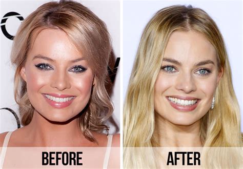 margot robbie before and after surgery|Fans Spot A ‘Huge Difference’ In Margot Robbie’s Appearance After ...